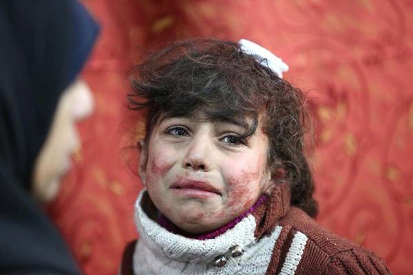 Thảm cảnh của những đứa trẻ tại “thánh địa” chết chóc Syria: Nỗi đau của các em vẫn chưa có hồi kết