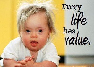Down Syndrome Does Not Make Life Disposable